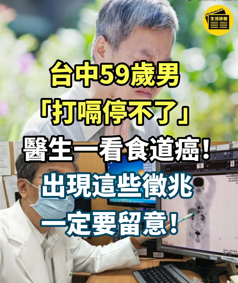 台中59歲男「打嗝停不了」，醫生一看「食道癌」！出現這些徵兆一定要留意，很多人都忽視！快傳給親朋好友看！