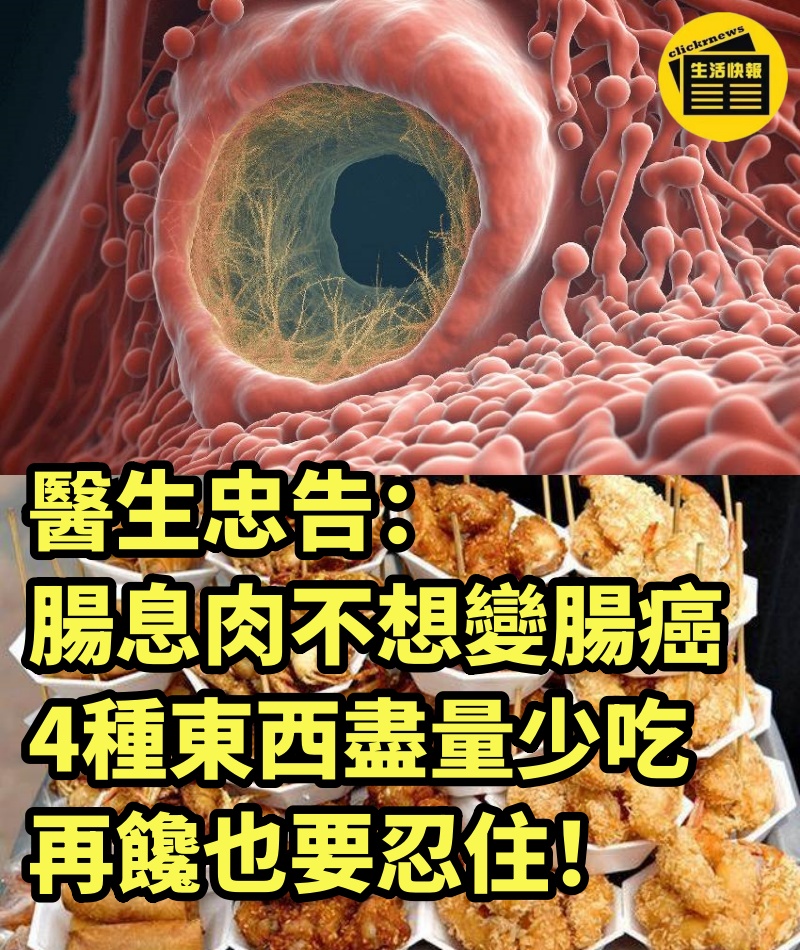 醫生忠告：腸息肉不想變腸癌，4種東西盡量少吃，再饞也要忍住