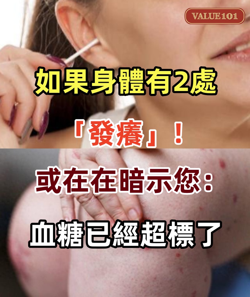 如果身體有2處「發癢」,或在在暗示您:血糖已經超標了